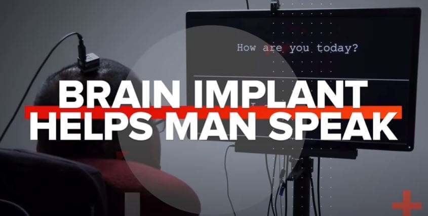 Watch a brain implant help this man 'speak' for the first time in 15 years